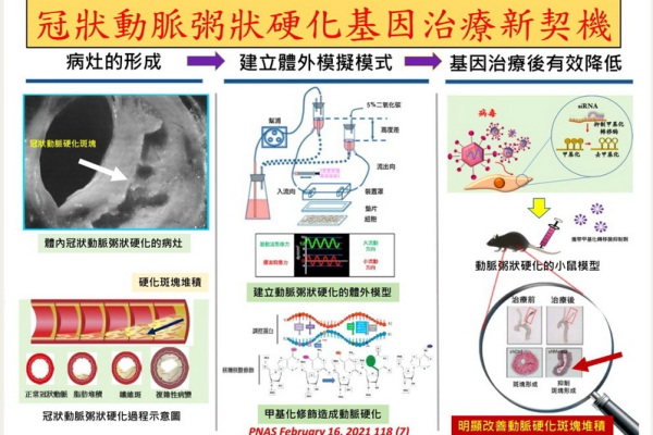 冠狀動脈硬化之形成與基因治療之效果。(圖/陽明交通大學提供)