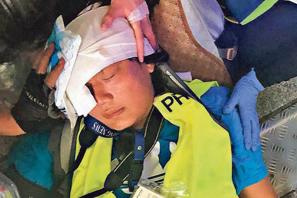 印尼女記者英達遭港警爆眼恐失明/民陣臉書